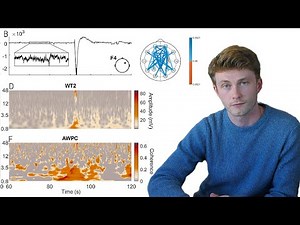 EEG Phase Coherence in Autism Spectrum Disorder with Dr Sam Barnes