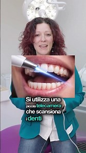 Impronta Digitale Dentale: Addio Pasta Fastidiosa!