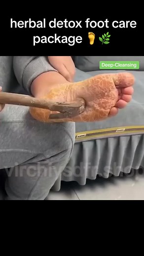 Revitalize Your Feet with Herbal Detox Foot Care Package