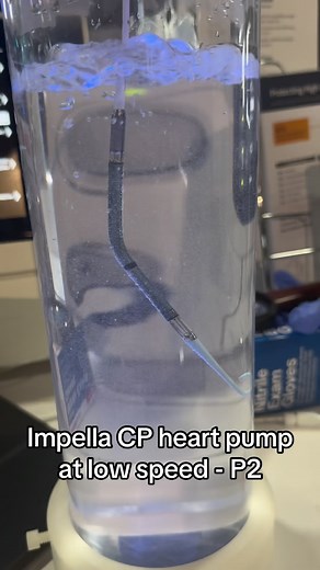 Ali Haider, MD on Instagram: "Impella CP percutaneous left ventricular assist device is a temporary heart pump that can increase flow and help support the heart during cardiogenic shock. You can see how it works here helping the heart circulate blood by sucking in blood from the inflow and pushing it out the outflow. This gives you an idea of its various speeds and power. Recently the Danger Shock randomized study showed a benefit in using this device for post MI cardiogenic shock. The only posi