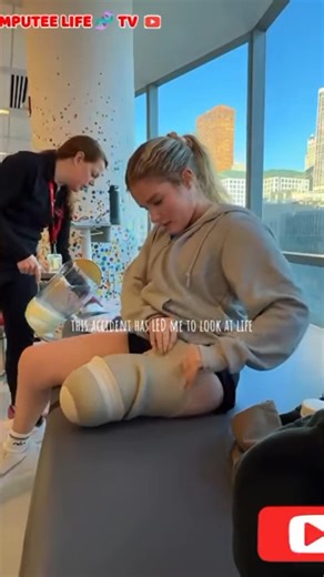 Amputee lady putting on prosthetic leg #limbloss #artificiallimb