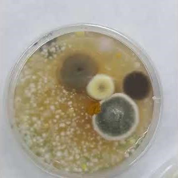 Microbiología: Cultivo y siembras en placas petri