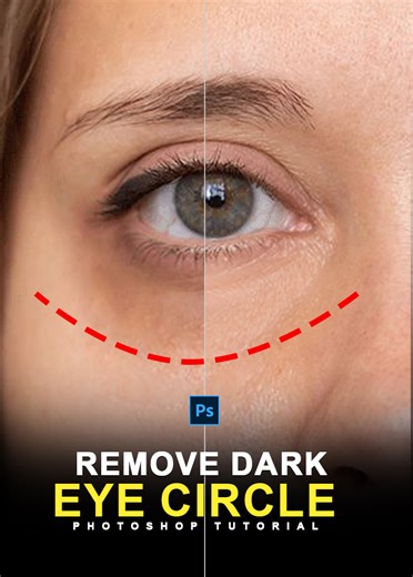 216K views · 1.4K reactions | Dark Eye Circle Remove in Photoshop | Photoshop Tricks and Tips #darkeyecircles #eyecircles #eye #darlcirclesremove #photoshoptutorial #adobephotoshop #photoshopediting #tutorial #shortsvideo #adobe #photoshop #adobephotoshop2024 #adobephotoshop #adobephotoshopcc2019 | Graphics Solution Tricks | Facebook