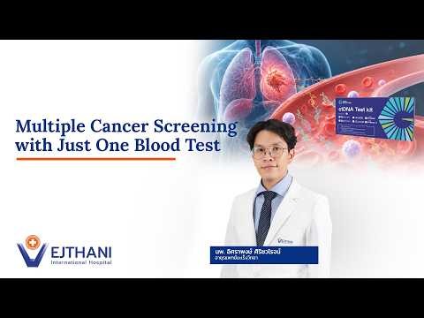 Cancer Screening: Screen for 10 Types of Cancer with One Blood Test