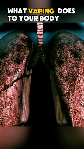 3.2K views · 18 reactions | 99.Ever wondered what vaping does inside your body, watch before you vape again . Disclaimer educational video for public and young trainees. #vaping#vapingawareness #healtheducation #quitvaping #medic | Surgery Page | Facebook