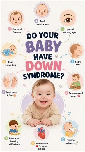 Do Your Baby Have Down Syndrome? Common Signs Explained