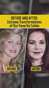 Before and After: Extreme Transformations of Our Favorite Celebs | You're Gorgeous