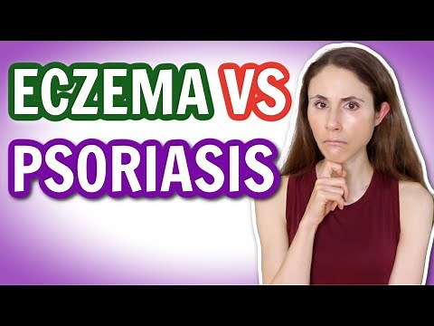 ECZEMA VS PSORIASIS: HOW TO TELL THE DIFFERENCE 🤔 ‪@DrDrayzday‬