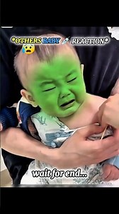 Others Baby Injection Reaction | #edit #shorts #trending #fyp