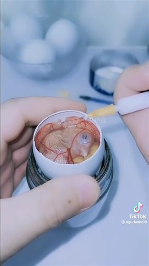 19 reactions · 4 comments | Each year, more than 100 million...