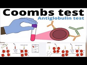 DIRECT vs INDIRECT COOMBS TEST