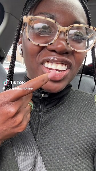 Chipped Tooth Repair: My Journey to a Perfect Smile