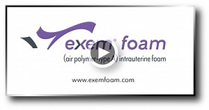 The ExEm® Foam Procedure