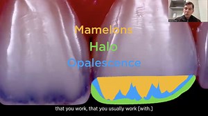 TOOTH MORPHOLOGY - breaking down the anatomy of a tooth can greatly help you understand the details needed for anterior composite restorations. Master clinician Dr. Klecio Alves shows how upping the contrast on a photo of a tooth allows you to study details such as mamelons, halo, and opalescence. ⁠ ⁠ This becomes a guide for building these elements into the restoration, using Renamel NANO Plus and Renamel Microfill to create the areas of opacity and translucency. ⁠ ⁠ There are still a few seats