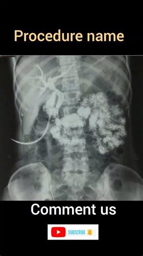 procedure name #viral #shorts #youtubeshorts ‪@AzhaR-live-5.2k-view‬