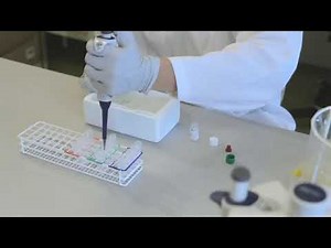 Diluting positive control, negative control, samples - Performing Wieslab Complement System Screen