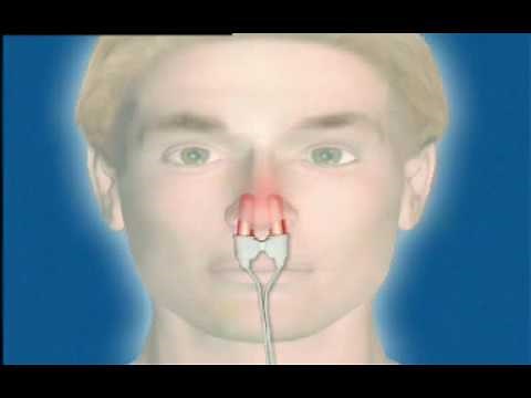 Bionase