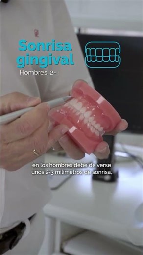 ¿Tienes sonrisa gingival? | Clínica Menéndez
