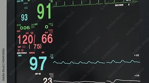 Monitor vital sign and EKG monitor in ICU unit ,it show The waves of blood pressure, blood oxygen saturation, ECG,heart rate,respiratory rate. Stock Video