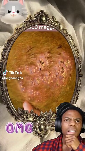 Understanding Dog Parasites and Their Treatment