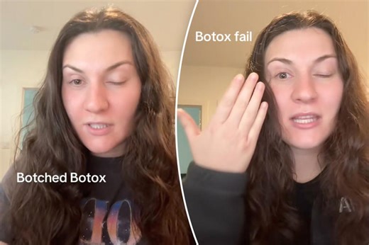 Stunned patient shares terrifying Botox experience that left her scarred