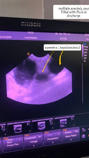 Dr. Epsa Sharma on Instagram: "Ultrasound imaging of pyometra in a canine: A distended, fluid-filled uterus is visualized, consistent with pyometra. The anechoic to hypoechoic luminal contents and thickened uterine walls indicate an active infection requiring prompt medical or surgical intervention."