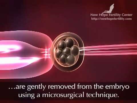 Preimplantation Genetic Diagnosis (PGD)