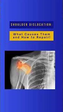 SHOULDER Dislocations: Discover the Causes and Quick Repairs!