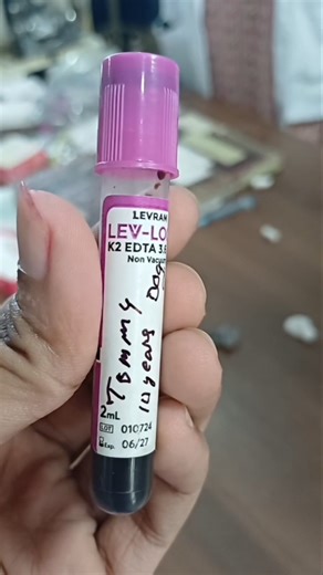 Preparation of blood smear // Pathology practical // BVSc & AH // Ranchi Veterinary college.