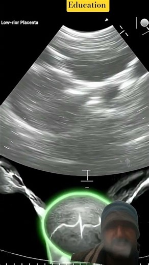 How Ultrasound Machine Works | Fetal Growth Explained in 3D | Pregnancy Ultrasound Scan #education