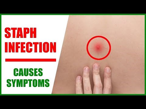Staph Infections of the Skin – Staph Infection Symptoms | Staphylococcus Aureus and Treatment