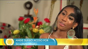 "Miss Colombia: Modelo con lunar en el rostro rompe estándares de belleza"- Así titula Telemundo la historia de Patricia Cuero, Miss Valle, en entrevista con el programa "Un Nuevo Día". | MISS COLOMBIA LA NUEVA ERA