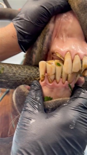 Did you know this isn't a rare condition. Brachygnathism or parrot mouth.