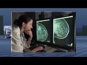 UCSF Radiology: MRI-Guided Breast Biopsy