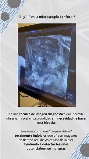 ¿Que es la microscopia Confocal?