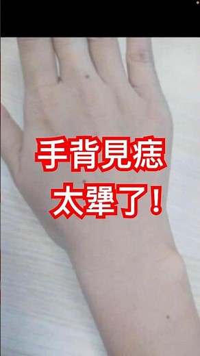 手背有痣的手相，佔有欲極強？