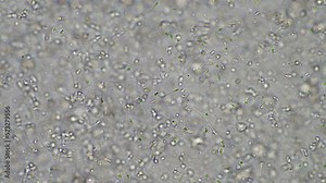 Sperm under the microscope. Looking a semen swimming. Healthy fertile man high sperm count