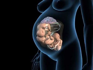 Types of triplets pregnancy - Monochorionic triamniotic triplets - 3D Anatomical Visualization