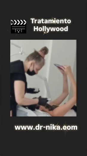 Peeling Hollywood de carbón activo con Pico laser para zona facial, cuello y escote