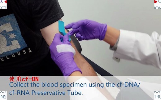 液体活检-如何长期保存游离的cfDNA和cfRNA-new