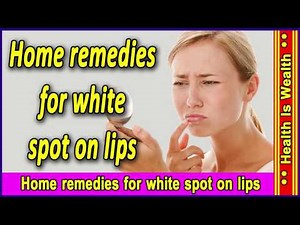 Home remedies for white spot on lips - सफ़ेद दाग के घरेलू उपचार