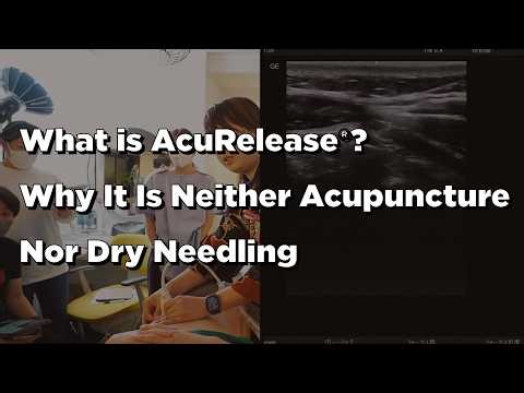 What is AcuRelease®?｜Why It Is Neither Acupuncture Nor Dry Needling
