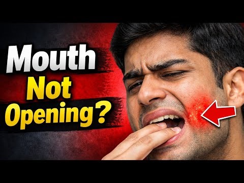 Day-129 Mouth Properly Open Nahi Ho Raha?Early Sign of Oral Cancer|Oral Submucous Fibrosis Awareness