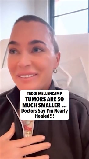 #TeddiMellencamp's on the road to recovery ... 'cause she says her tumors have shrunk significantly. Read the full story: https://www.tmz.com/2025/04/23/teddi-mellencamp-says-tumors-have-shrunk/ 🎥: Instagram / teddimellencamp | TMZ