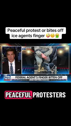 Peaceful protester bites off ice agents finger#creatorsearchinsights #new #trump #republican #usa