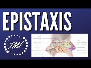 Epistaxis Explicado Claramente