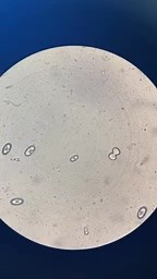 9.1K views · 208 reactions | Urine crystal❤️❤️ Calcium oxalate or uric acid crystals?? which one are you going for. | Lab life | Facebook