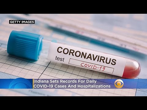 Coronavirus In Indiana: State Sets Records For Daily COVID-19 Cases, Hospitalizations