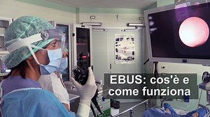 EBUS, LA SONDA ECOGRAFICA PER LA STADIAZIONE DEL TUMORE AL POLMONE Ecco come funziona EBUS (Endobronchial Ultrasound), un esame all'avanguardia eseguito presso il servizio di Endoscopia Toracica che permette di intervenire con precisione ed efficacia sulle strutture adiacenti alla trachea e ai bronchi | IRCCS Ospedale Sacro Cuore / don Calabria di Negrar