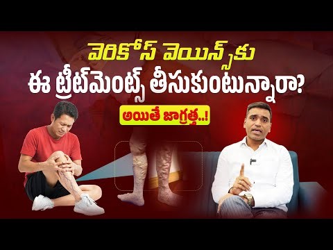 Varicose Veins Treatment Explained | Laser vs Glue Therapy | Dr. Sridhar Devu